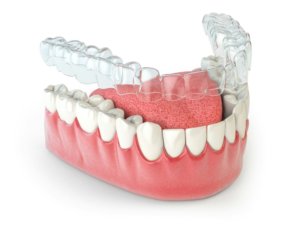 Invisalign invisible retainer or braces with lawer jaw islated on white.