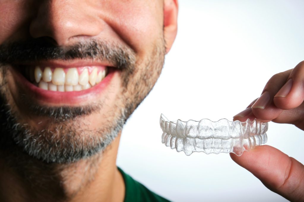 Clear Aligners for Teeth